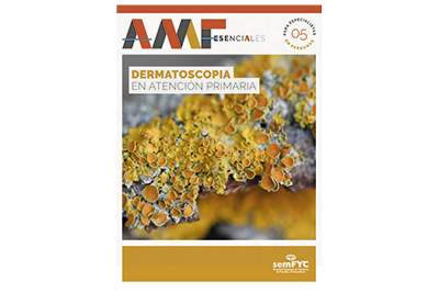 Dermatoscopia en Atención Primaria - AMF esenciales (para especialistas en personas)